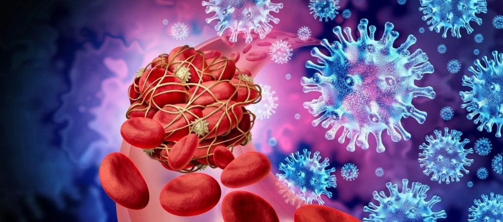Plaquetas sanguíneas envueltas por la proteína fibrinógeno y el virus de la espiga COVID-19